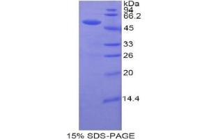 SDS-PAGE analysis of Human UPRT Protein. (Uracil Phosphoribosyltransferase (UPP) 蛋白)