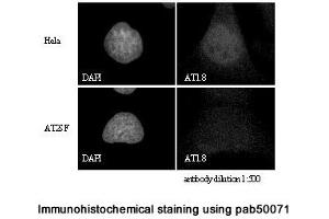 Image no. 2 for anti-Ataxia Telangiectasia Mutated (ATM) (C-Term) antibody (ABIN363380) (ATM 抗体  (C-Term))
