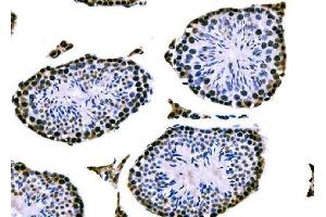 IHC analysis of RRS1 using anti-RRS1 antibody (ABIN7601344). (RRS1 抗体  (AA 33-266))