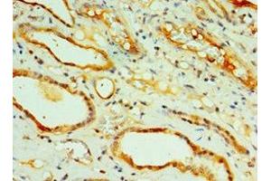 Immunohistochemistry (IHC) image for anti-CAMP Responsive Element Binding Protein 3-Like 2 (CREB3L2) (AA 1-247) antibody (ABIN7148820)