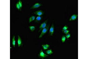 Immunofluorescent analysis of A549 cells using ABIN7169532 at dilution of 1:100 and Alexa Fluor 488-congugated AffiniPure Goat Anti-Rabbit IgG(H+L) (DHRS3 抗体  (AA 30-169))