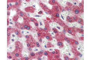 Immunohistochemistry (IHC) image for anti-Hydroxysteroid (11-Beta) Dehydrogenase 1 (HSD11B1) (N-Term) antibody (ABIN2773867) (HSD11B1 抗体  (N-Term))