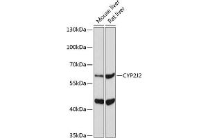 Western blot analysis of extracts of various cell lines, using CYP2J2 Antibody (ABIN6134306, ABIN6139339, ABIN6139340 and ABIN6221491) at 1:1000 dilution. (CYP2J2 抗体  (AA 200-300))