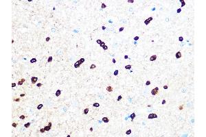 Immunohistochemistry of paraffin-embedded rat brain using TPPP/p25 Rabbit mAb (ABIN7271031) at dilution of 1:100 (40x lens). (Tppp 抗体)