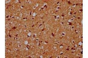 IHC image of ABIN7163112 diluted at 1:200 and staining in paraffin-embedded human brain tissue performed on a Leica BondTM system. (CDS2 抗体  (AA 354-445))