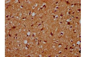 IHC image of ABIN7163112 diluted at 1:200 and staining in paraffin-embedded human brain tissue performed on a Leica BondTM system.
