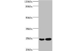 Western blot All lanes: RAN antibody at 2 μg/mL Lane 1: Hela whole cell lysate Lane 2: Jurkat whole cell lysate Secondary Goat polyclonal to rabbit IgG at 1/10000 dilution Predicted band size: 24 kDa Observed band size: 24 kDa (RAN 抗体  (AA 1-216))