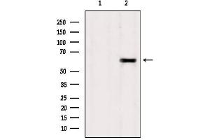 Western blot analysis of extracts from Sp2/0, using TCTN1 Antibody. (TCTN1 抗体  (N-Term))
