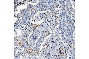 IHC analysis of ATG7 using anti-ATG7 antibody (ABIN7603109). (ATG7 抗体  (N-Term))
