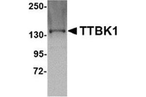 Western blot analysis of TTBK1 in Jurkat lysate with this product at 1 μg/ml. (TTBK1 抗体  (C-Term))