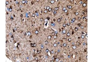 IHC analysis of MDH2 using anti-MDH2 antibody (ABIN7602618).