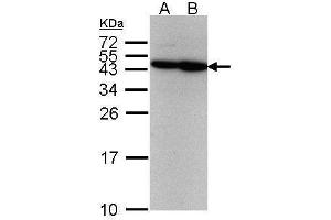 Western Blotting (WB) image for anti-Excision Repair Cross-Complementing Rodent Repair Deficiency, Complementation Group 8 (ERCC8) (Internal Region) antibody (ABIN2857082)