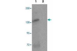 Western blot analysis of ATP2C2 in NIH/3T3 cell lysate with ATP2C2 polyclonal antibody  at 1 ug/mL in (1) the absence and (2) the presence of blocking peptide. (ATP2C2 抗体  (N-Term))
