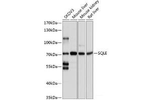 Western blot analysis of extracts of various cell lines using SQLE Polyclonal Antibody at dilution of 1:1000. (SQLE 抗体)