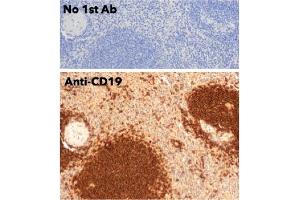 Immunohistochemistry (IHC) image for anti-CD19 Molecule (CD19) (C-Term) antibody (ABIN6254219) (CD19 抗体  (C-Term))