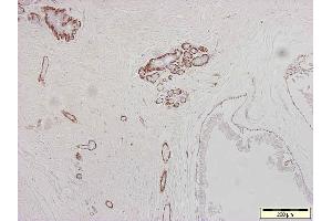 Image no. 1 for anti-Actin, alpha 2, Smooth Muscle, Aorta (ACTA2) antibody (ABIN335372) (Smooth Muscle Actin 抗体)