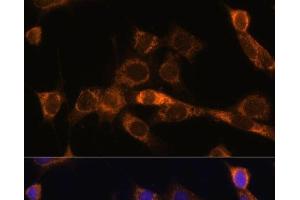 Immunofluorescence analysis of NIH/3T3 cells using FoxO3a Polyclonal Antibody at dilution of 1:100. (FOXO3 抗体)