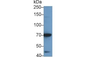 Detection of IL12Rb2 in BXPC3 cell lysate using Polyclonal Antibody to Interleukin 12 Receptor Beta 2 (IL12Rb2) (IL12RB2 抗体  (AA 559-647))