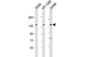All lanes : Anti-FMN1 Antibody (Center) at 1:2000 dilution Lane 1: A549 whole cell lysate Lane 2: HT-1080 whole cell lysate Lane 3: Jurkat whole cell lysate Lysates/proteins at 20 μg per lane. (FMN1 抗体  (AA 270-304))