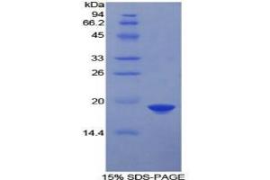 SDS-PAGE analysis of Human FDFT1 Protein. (FDFT1 蛋白)