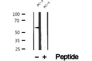 Western blot analysis of extracts of PC-3 cells, using ETV5 antibody. (ETV5 抗体  (Internal Region))