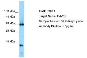 Host: Rabbit  Target Name: Ddx20  Sample Tissue: Rat Kidney lysates  Antibody Dilution: 1. (DDX20 抗体  (Middle Region))
