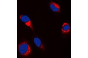 Immunofluorescent analysis of Tyrosinase staining in HepG2 cells. (TYR 抗体  (C-Term))