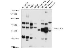 Western blot analysis of extracts of various cell lines, using  antibody (ABIN6129872, ABIN6136507, ABIN6136508 and ABIN6218899) at 1:1000 dilution. (ACVRL1 抗体)