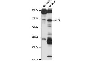 Western blot analysis of extracts of various cell lines, using CPB2 antibody (ABIN6293650) at 1:1000 dilution. (CPB2 抗体)