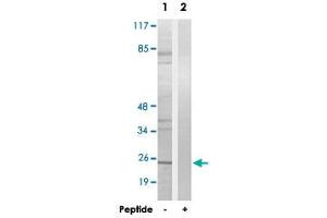 Western blot analysis of extracts from LoVo cells, using EIF4E3 polyclonal antibody . (EIF4E3 抗体)
