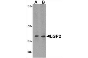 Western blot analysis of LGP2 in MDA-MB-361 cell lysate with this product at (A) 0. (DHX58 抗体  (N-Term))
