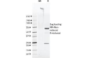 SDS-PAGE Analysis Purified FAT Mouse Monoclonal Antibody (FAT1-3D7/1). (FAT1 抗体  (Cytoplasmic Domain))