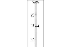 HBZ Antibody (C-term) (ABIN1881404 and ABIN2838673) western blot analysis in WiDr cell line lysates (35 μg/lane). (HBZ 抗体  (C-Term))