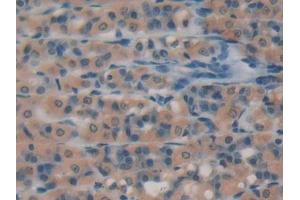 DAB staining on IHC-P; Samples: Rat Intestine Tissue (Caspase 3 抗体  (AA 29-175))