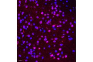 Immunofluorescence of paraffin embedded mouse brain using NSFL1C (ABIN7074865) at dilution of 1:650 (400x lens) (NSFL1C 抗体)