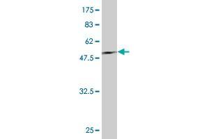 Western Blotting (WB) image for anti-Phosphoserine Phosphatase (PSPH) (AA 1-225) antibody (ABIN562500)