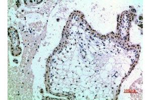 Immunohistochemical analysis of paraffin-embedded human-placenta, antibody was diluted at 1:200 (NOP56 抗体  (AA 191-240))