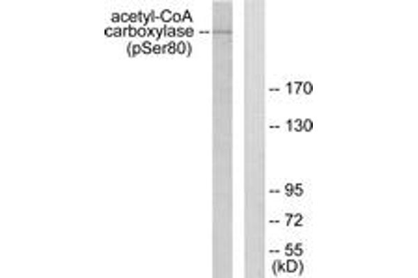 Acetyl-CoA Carboxylase 抗体  (pSer80)