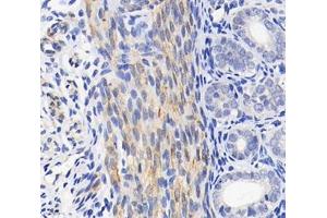 Immunohistochemistry (Paraffin-embedded Sections) (IHC (p)) image for anti-Tropomyosin 1 (Alpha) (TPM1) antibody (ABIN7076030)