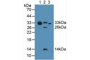 Western blot analysis of (1) Human Serum, (2) Mouse Heart Tissue and (3) Human Liver Tissue. (C1QA 抗体  (AA 28-245))