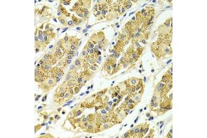 Immunohistochemistry of paraffin-embedded Human gastric using ARHGAP25 antibody at dilution of 1:100 (x400 lens). (ARHGAP25 抗体  (AA 1-370))