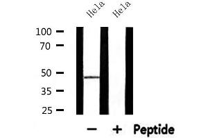 Western blot analysis of extracts from Hela, using ABHD8 Antibody. (ABHD8 抗体  (Internal Region))