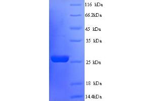 SDS-PAGE (SDS) image for Suppressor of Cytokine Signaling 3 (SOCS3) (AA 1-225), (full length) protein (His tag) (ABIN5713856)