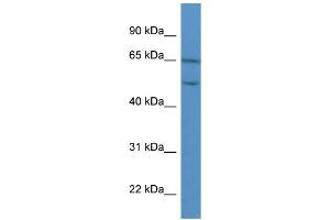 WB Suggested Anti-COL8A2 Antibody Titration: 0. (COL8a2 抗体  (C-Term))