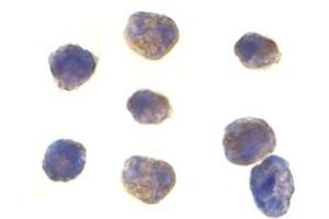 Immunocytochemistry of TAB1 in K562 cells with this product at 1 μg/ml. (TAB1 抗体  (Center))