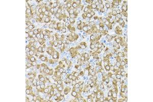 Immunohistochemistry of paraffin-embedded rat ovary using THUMPD3 Rabbit pAb (ABIN6132951, ABIN6149133, ABIN6149134 and ABIN6214652) at dilution of 1:200 (40x lens).