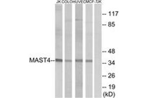 Western blot analysis of extracts from Jurkat/COLO/HuvEc/MCF-7 cells, using MAST4 Antibody. (MAST4 抗体  (AA 251-300))