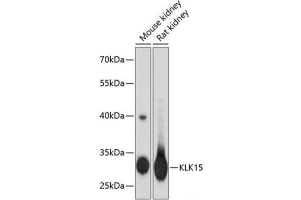Kallikrein 15 抗体