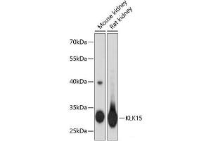 Western blot analysis of extracts of various cell lines using KLK15 Polyclonal Antibody at dilution of 1:3000. (Kallikrein 15 抗体)