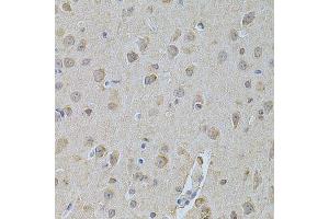 Immunohistochemistry of paraffin-embedded mouse brain using NME1 Antibody. (NME1 抗体  (C-Term))